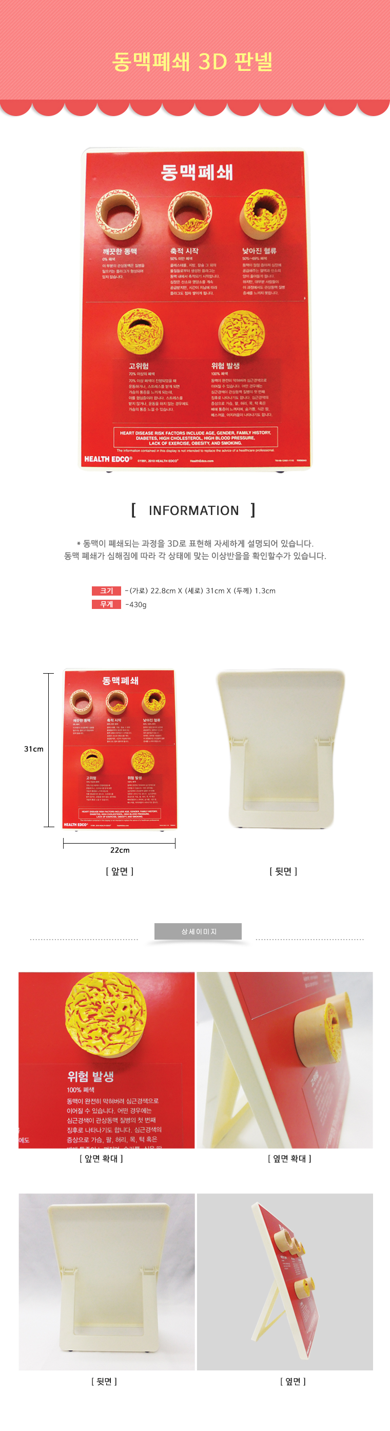 동맥폐쇄 3d판넬.jpg