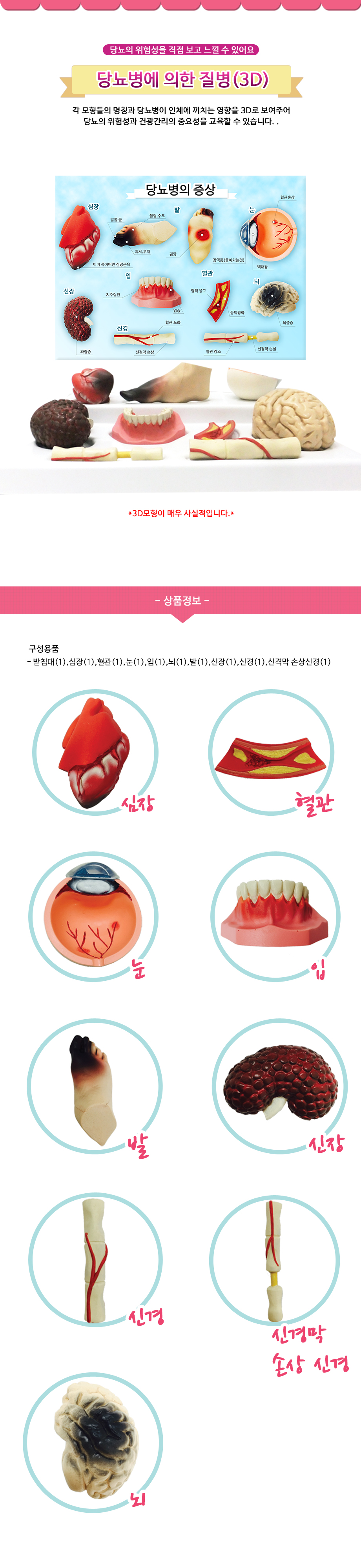 수정당뇨병에의한질병.jpg