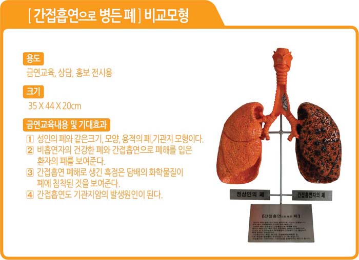 122.간접흡연으로 병든폐 비교모형(kim3-154)(상세페이지).jpg