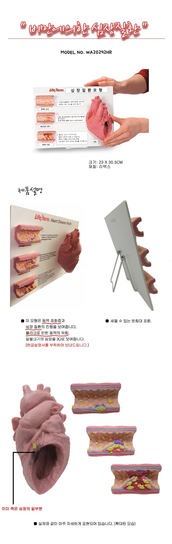 비만의 의한.jpg