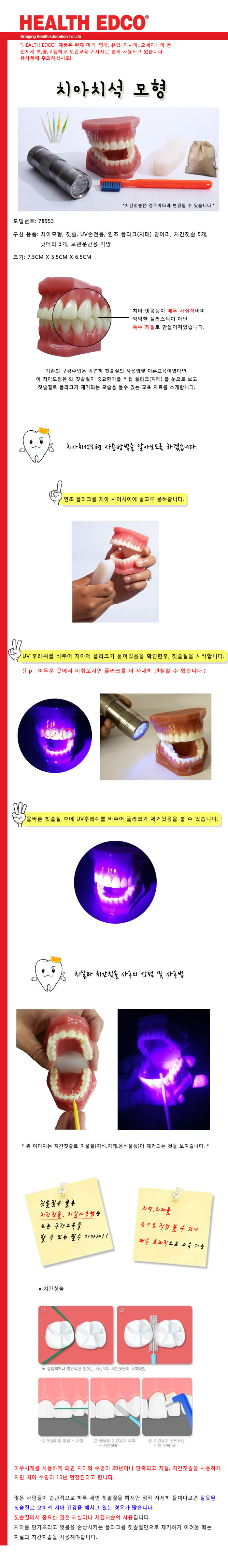 치아치석.jpg