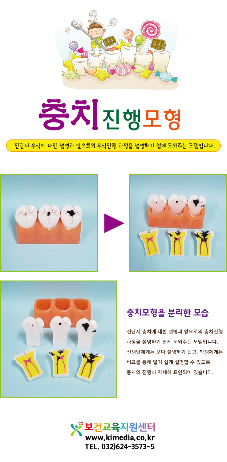 치아모형상세페이지.jpg