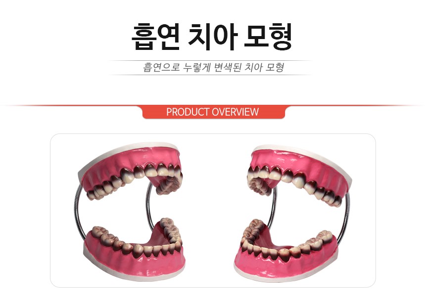 흡연치아모형-1.jpg