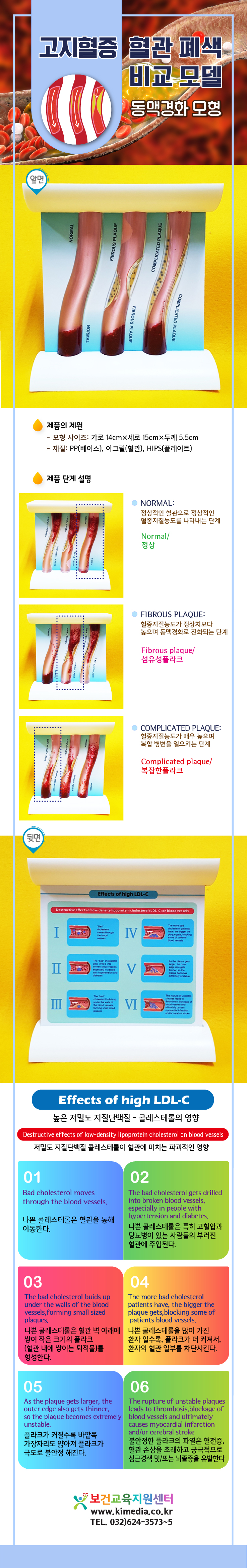 동맥상세페이지.jpg