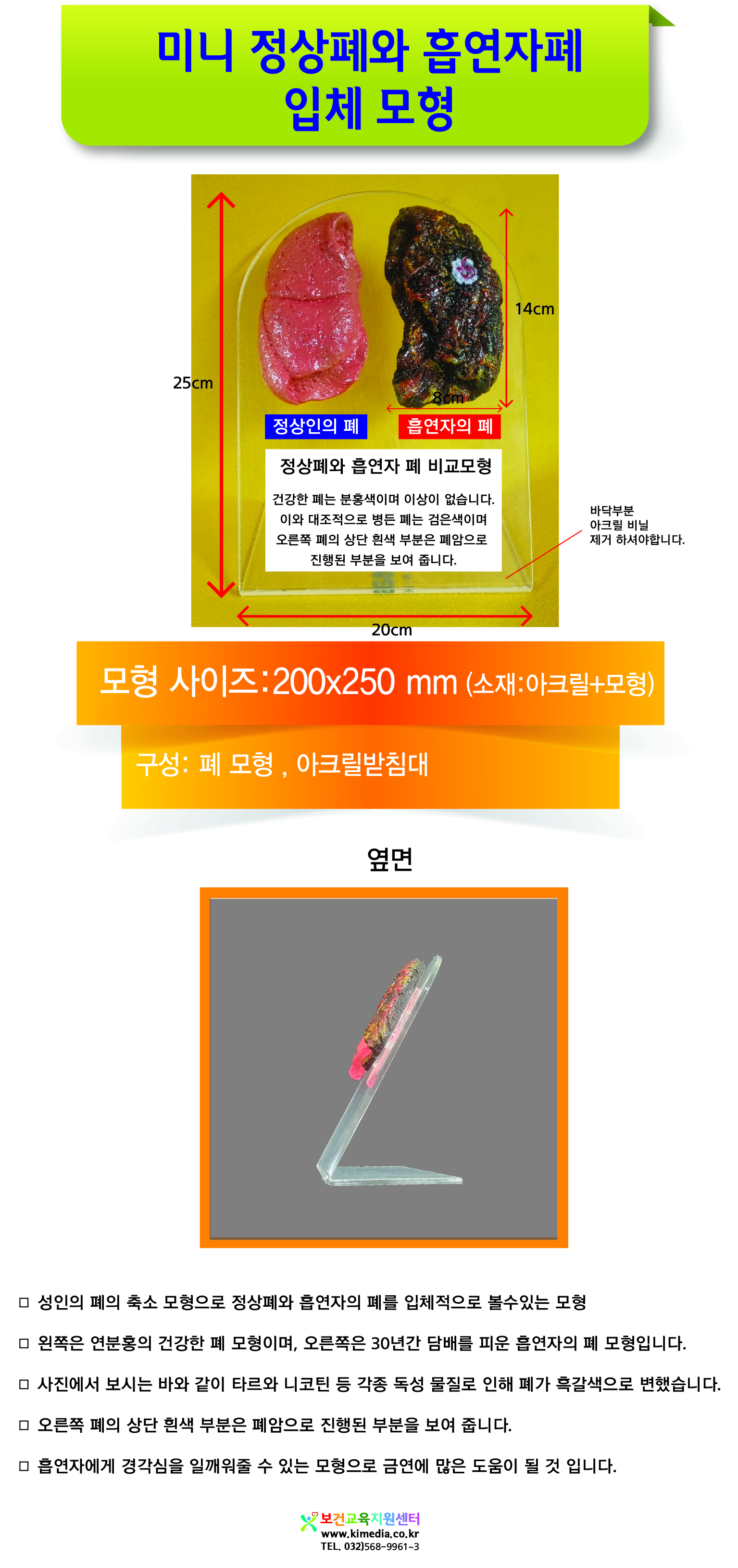 정상폐와 흡연자폐 비교모형 상세페이지-01-01.jpg