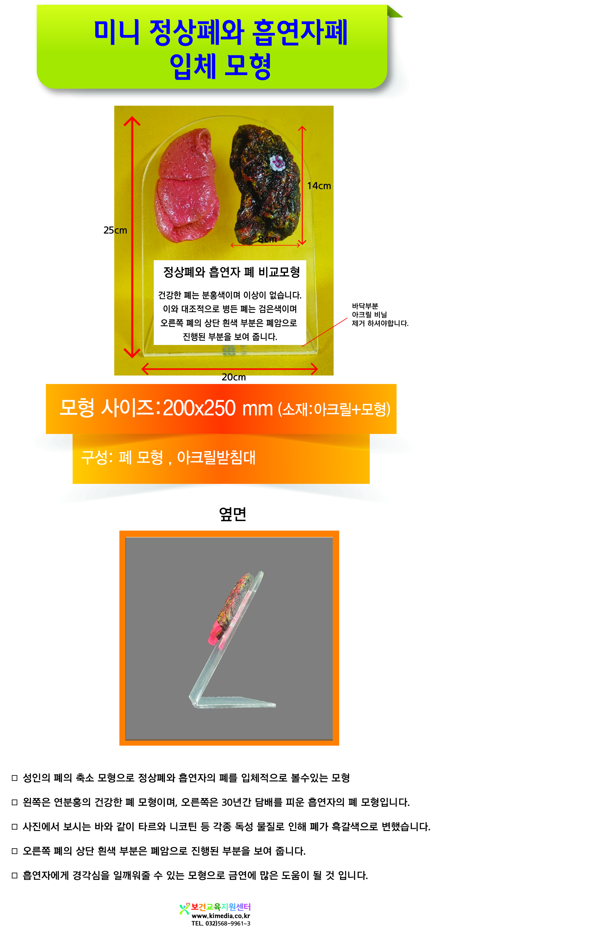 정상폐와 흡연자폐 비교모형 상세페이지-01.jpg